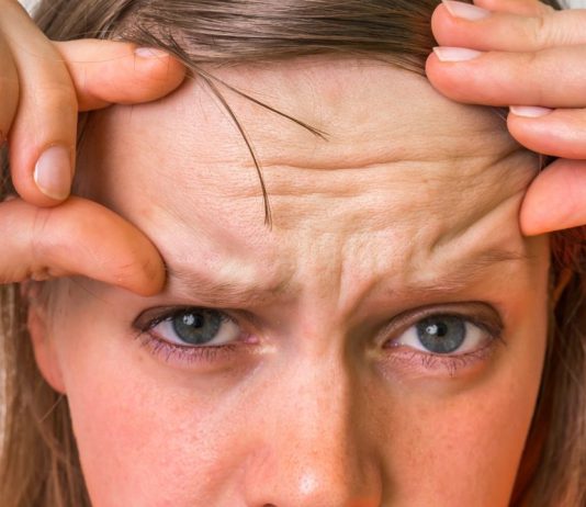 הרמת פנים ללא ניתוח